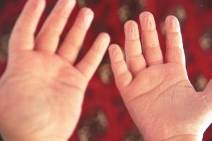 zvraskavene prsty vo vode