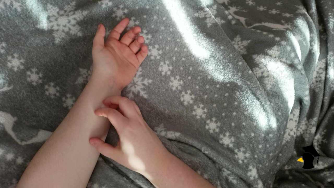 svrbenie