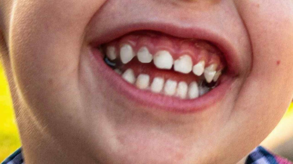 Prečo má človek detské zuby a nepríde rovno s trvalými?