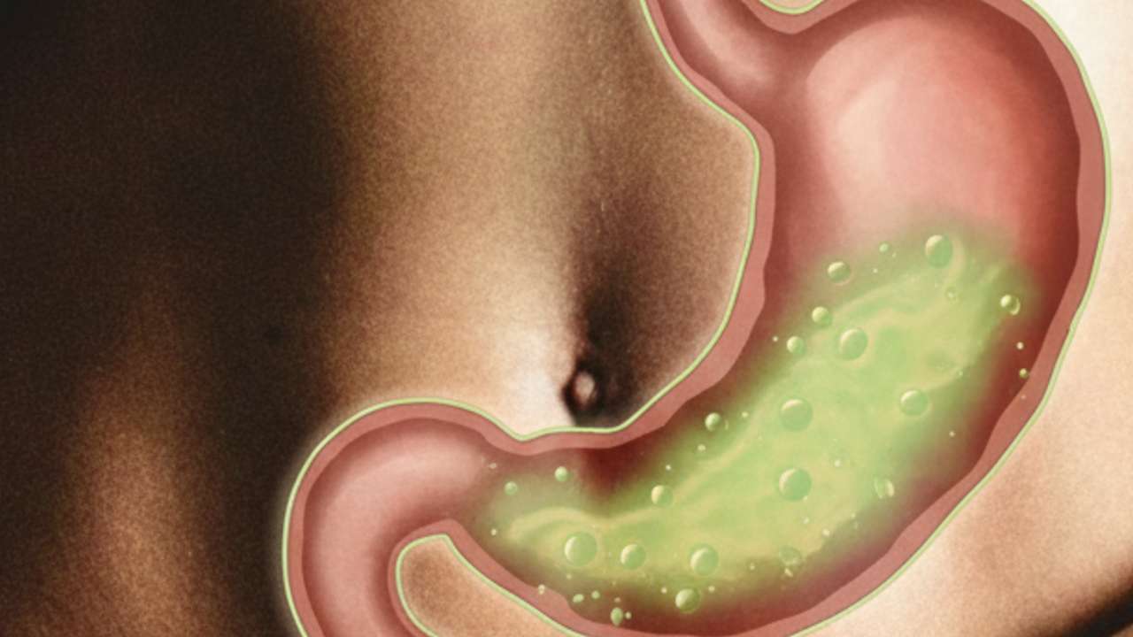 zaludok s zaludocnou kyselinou