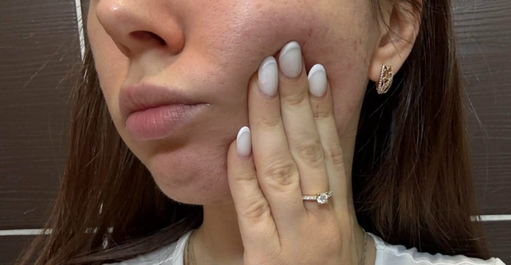 Bolesť zubov vie byť neznesiteľná. Tieto rady ti pomôžu prečkať najhoršie hodiny, kým sa dostaneš k zubárovi