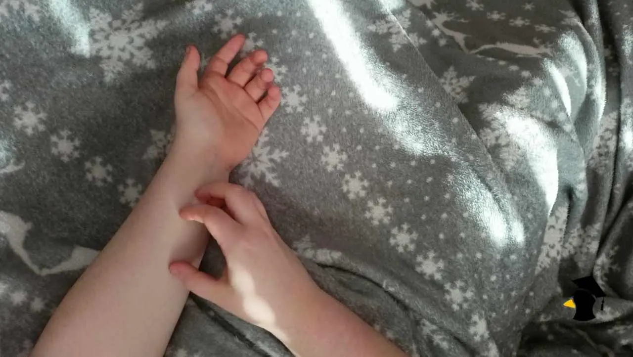 svrbenie